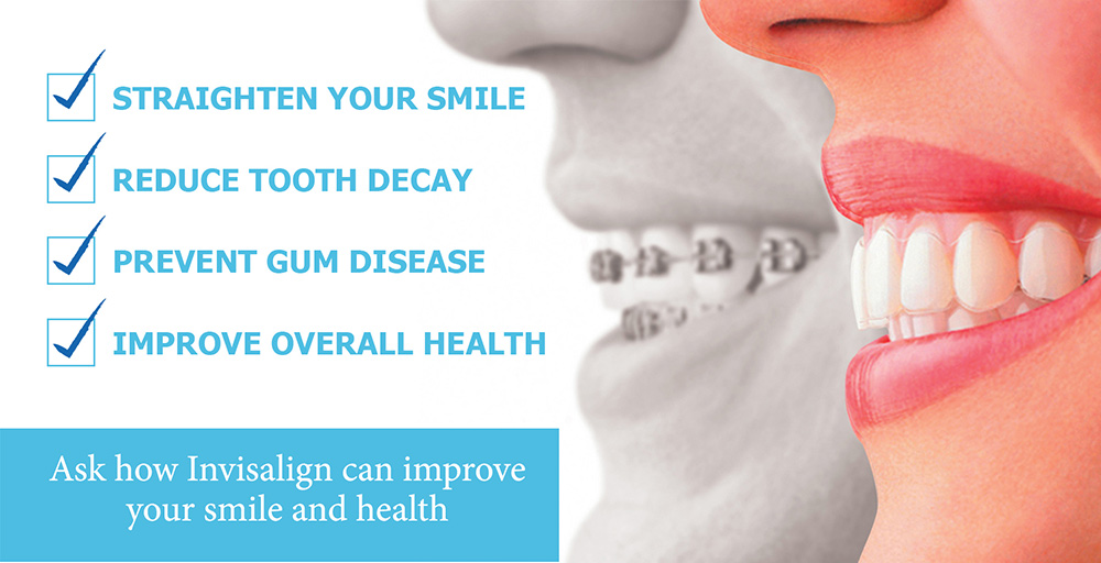 Invisalign treatment in Bedminster NJ